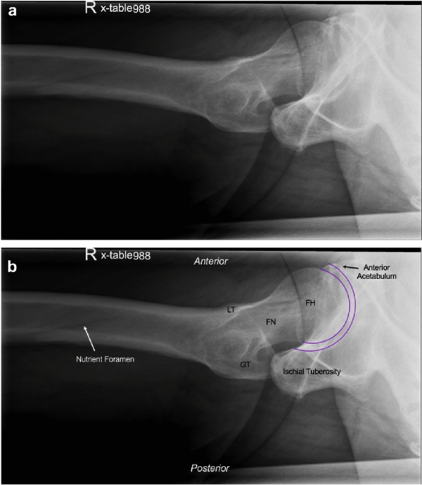 Cross-table lateral view