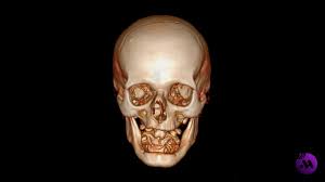 CT Scan, Skull, Skull Bone 3D recon